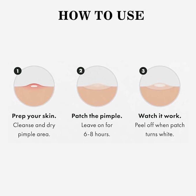 ABC Pimple Patch (72 Count)