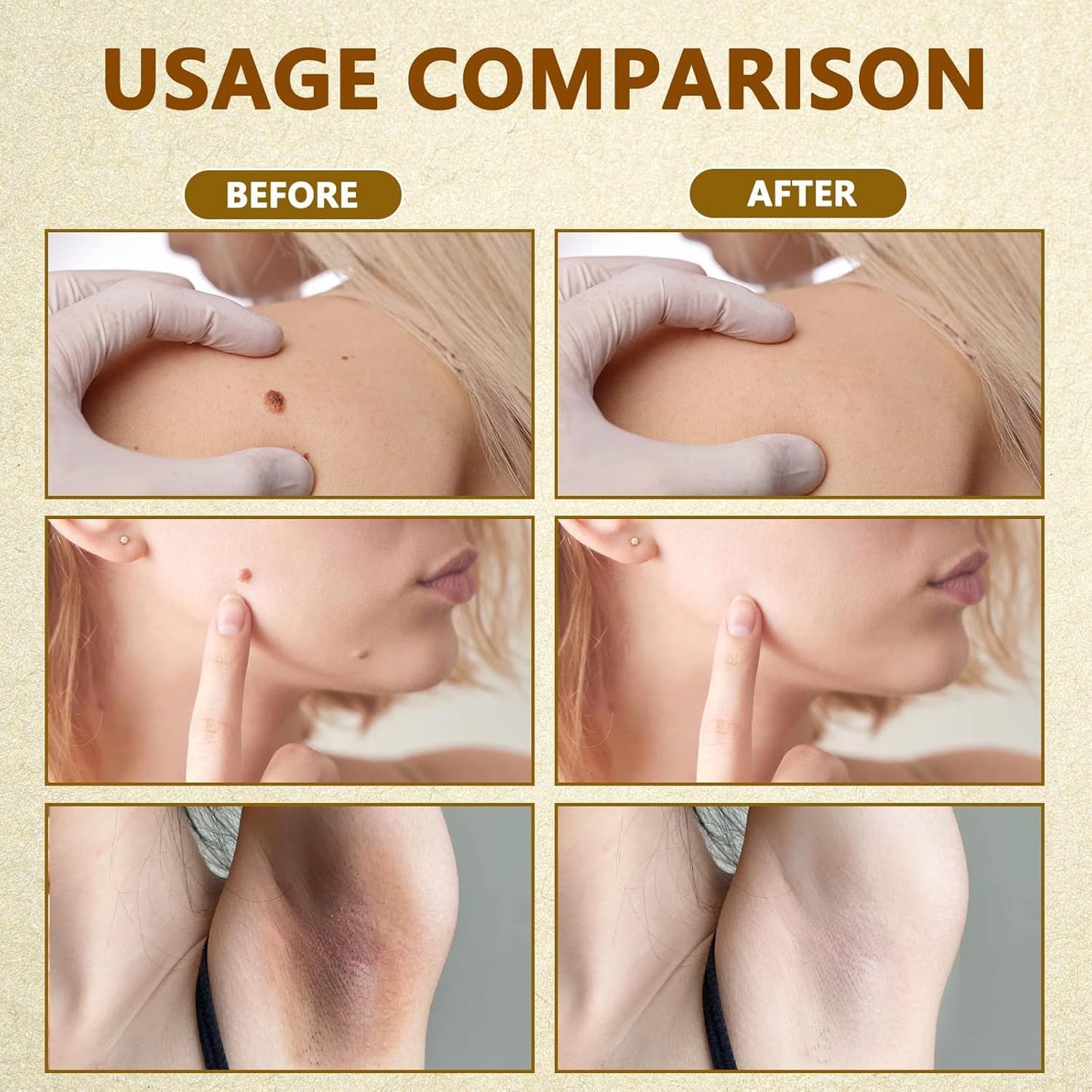 Bee Venom Skin Restoration Cream, Bee Venom Skin Treatment Cream, Repair and Wrinkle Reducing Comprehensive Moisturizer for All skin Types 2PC