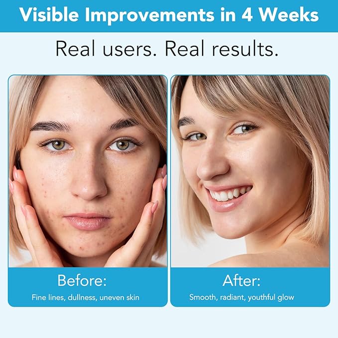 Anti Aging Vitamin C Serum Hyaluronic Acid Serum Set - with Hyaluronic Acid, Skin Care Set Boost Skin Collagen,Hydrate & Plump Skin, Anti Aging & Wrinkle Facial Serum