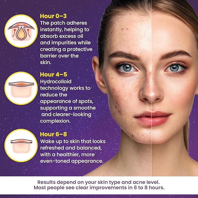 280Pcs Star Pimple Patches for Face - Hydrocolloid Acne Blemish Pimple Patches Cute Stars - Glitter, Regular, Glow in the Dark, Translucent 7 Colors, 3 Sizes Zit Stickers