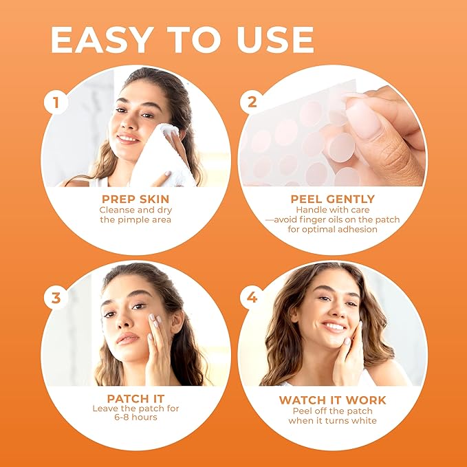 Acne Patches (120 Count), Hydrocolloid Pimple Patches for Face - Zit Patch Acne Dots - Cystic Acne Patches Treatment - Pimple Patch with 3 Size Acne Stickers