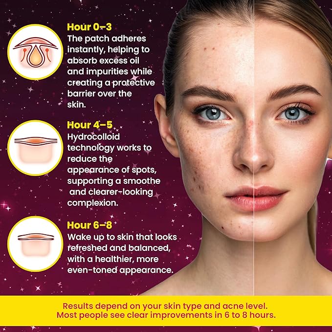 Andlane 280Pcs Star Pimple Patches for Face - Pimple Patches Cute Stars - Hydrocolloid, Salicylic Acid, Tea Tree Oil, Centella - Pink Color, 3 Sizes Zit Stickers