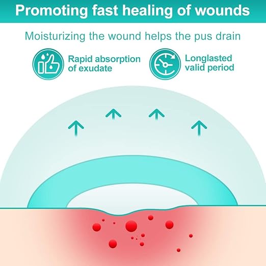 Dimora Hydrocolloid Dressing 4" x 4" for Wound Care, 10 Pcs Large Patch Bandages with Self-Adhesive for Bedsore, Burn, Blister, Acne Care, Super Absorbent for Fast Healing