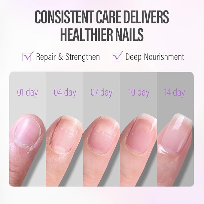 CHUCHU Nail Strengthener - Blueberry Scent Nail Repair Growth Moisturizing Treatment - Natural Jojoba Vitamin B & E Cuticle Oil for Dry Cracked Nails