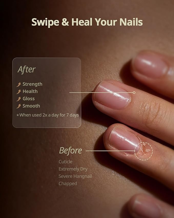 BTARTBOXNAILS Nutri-Forte Cuticle Oil - Pure Oil Formula with Olive Oil, Vitamin E, Squalane, Deep Repairing & Nourishing & Strengthening Treatment for Severe Nail Concerns, 15ml