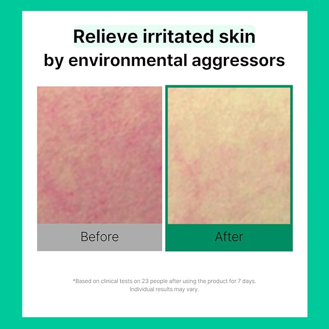 Cell Fusion C Post Alpha CICA Cooling Toner Pad, Redness Relieving & Cooling Korean Toner Pads, Centella Asiatica and Madecassoside, 70 Pads / 6.08 fl.oz.