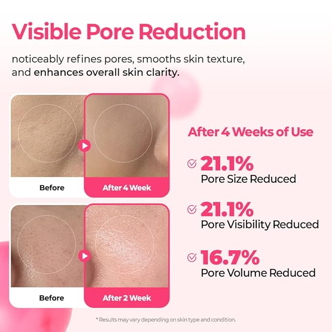 Cemenrete Cyano Pink Spicule Serum with Calcium, pore tightening refines pores tightening serum 1.01 fl. oz.