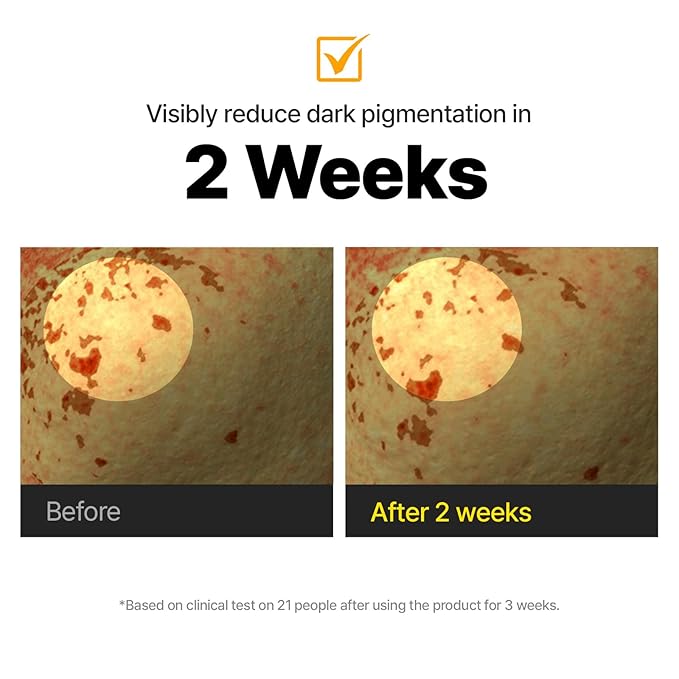 Cell Fusion C Toning C Vita Shot Ampoule, 15% Vitamin C + Spicule 300 Shot, Skin Booster Serum for Face, Exfoliation & Dark Spots, 20g / 0.7 oz.