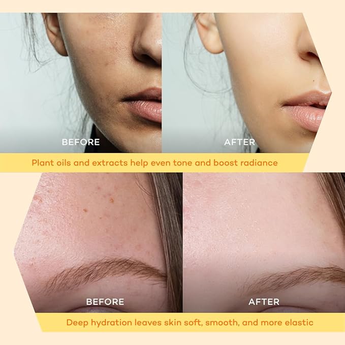 Bliss Facial Serum, Oil-Based Alternative to Vitamin C Serum for Face – Smooth Hydrating Serum with Vitamin E, Almond Oil, Squalane, Flower Extracts - For Dry and Sensitive Skin - 20ml