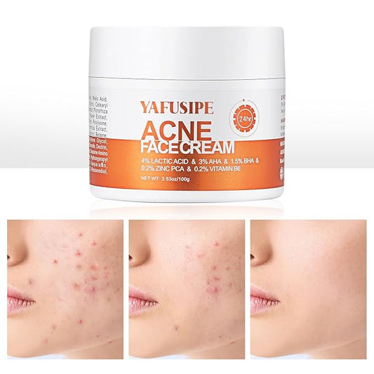 Acne Treatment for Face for Hormonal Cystic Stubborn Acne Cream for Sensitive Skin Teens Adults Women Men Spot Pimple Butt Control Rapid Clearing Breakout Overnight Face Blemish Treatment Moisturizer