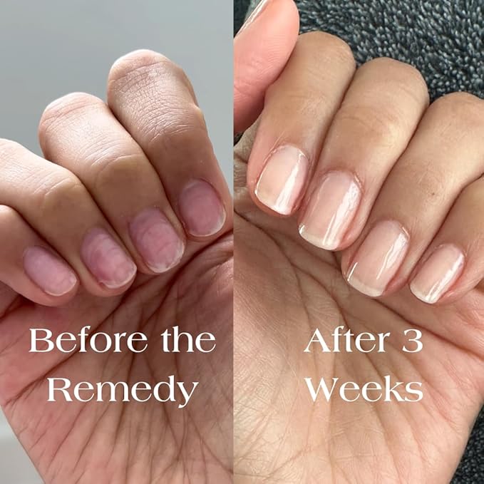 Botanist The Remedy | Nail Strengthening Polish | Repairs & Hardens Nails Damaged from Acrylics, Dip & Gel Manicures | Non-Toxic, 84% Plant Based, 21-Free & Vegan (Nude)