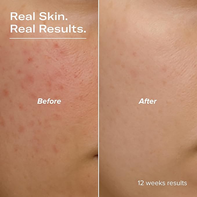 BRIGHTEN 15% Stabilized Vitamin C Serum with Glutathione, Ferulic Acid, Hexylresorcinol, Kakadu Plum, Vitamin E, Brightening, Glowing Skin, Anti-Aging 1 fl oz