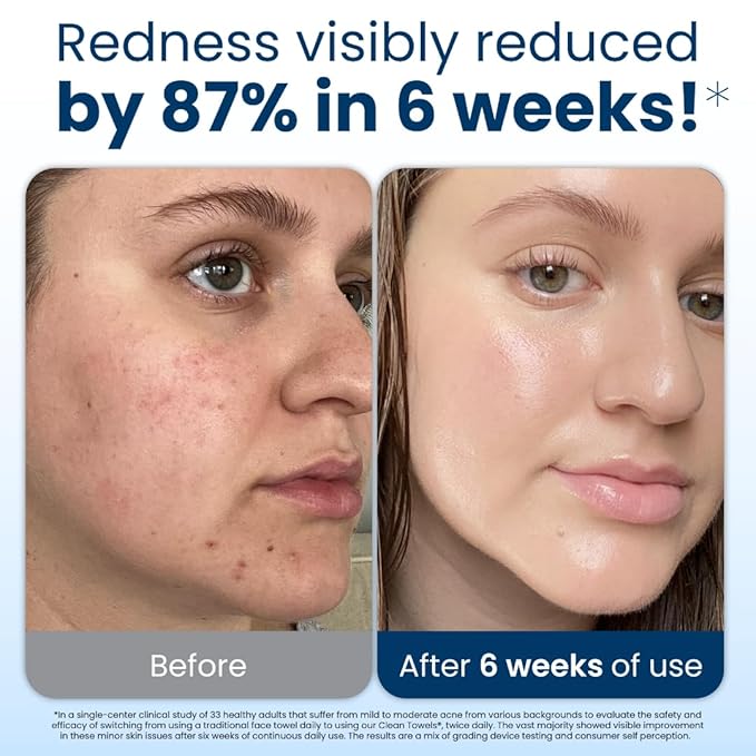 Clean Skin Club Clean Towels XL®, 100% USDA Biobased Face Towel, Disposable Face Towelette, Eczema Association Accepted, Makeup Remover Dry Wipes, Ultra Soft, 50 Count