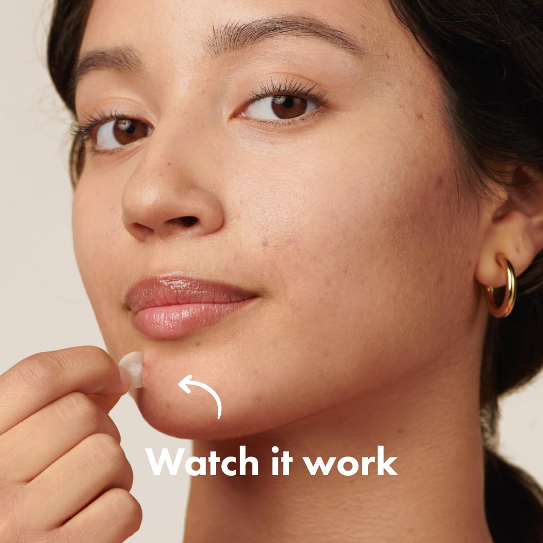 Mighty Patch™ Original patch from Hero Cosmetics – The #1 Hydrocolloid Acne Pimple Patch for Shrinking Zits and Whiteheads in 1 use; Nighttime Spot Stickers for Face and Skin (36 Count)