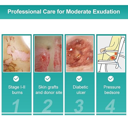 Dimora Hydrocolloid Dressing 4" x 4" for Wound Care, 10 Pcs Large Patch Bandages with Self-Adhesive for Bedsore, Burn, Blister, Acne Care, Super Absorbent for Fast Healing