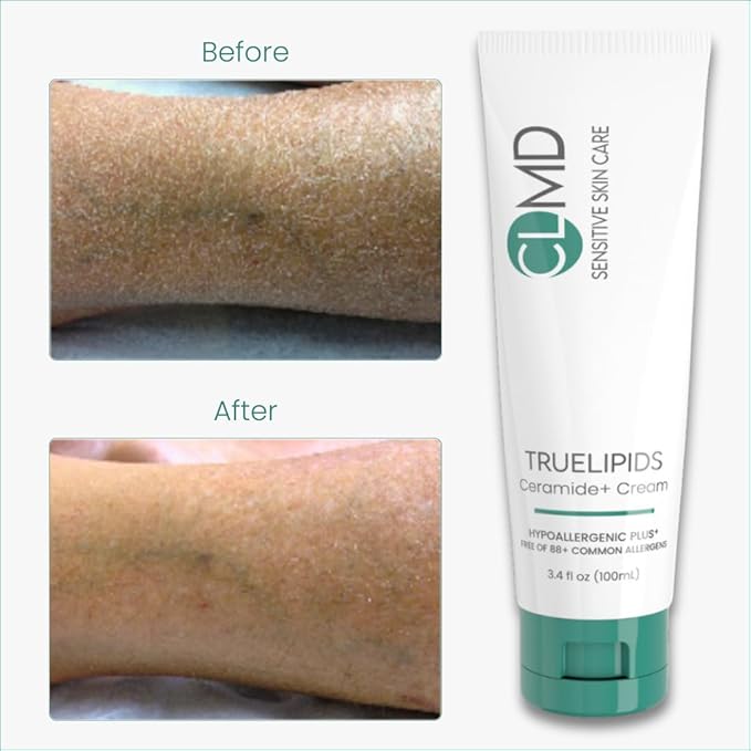 CLMD TrueLipids Ceramide+ Cream – Deep Moisturizing Barrier Support for Sensitive Skin – Hydrates and Soothes – Hypoallergenic, Nourishing, and Dermatologist-Tested – 3.4 fl oz