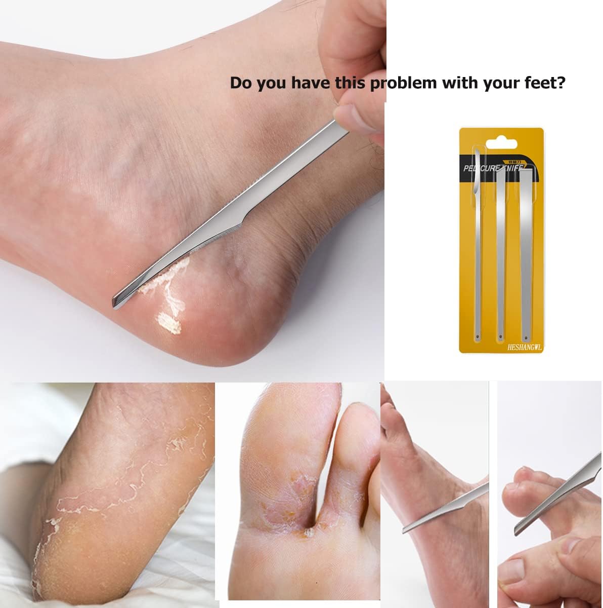 3PCS Stainless Steel ingrown toenail Pedicure Knife Set, Professional Foot Skin Scraper Repair Sharp Blade kit for Nail Corn Callus Paronychia Treatment (with Holes)