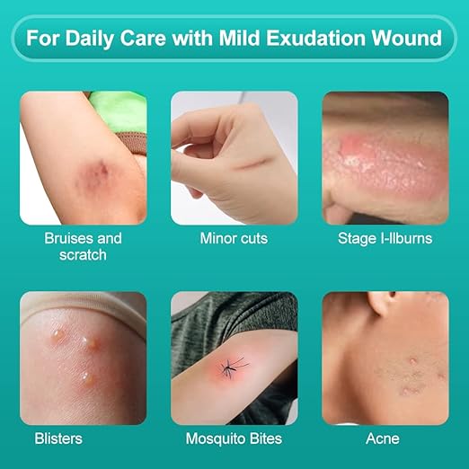 Dimora Hydrocolloid Wound Dressing, 10 Pcs Ultra Thin 4" x 4" Large Patch Bandages with Self-Adhesive, Fast Healing for Bedsore, Burn, Blister, Acne Care, Sterile and Waterproof