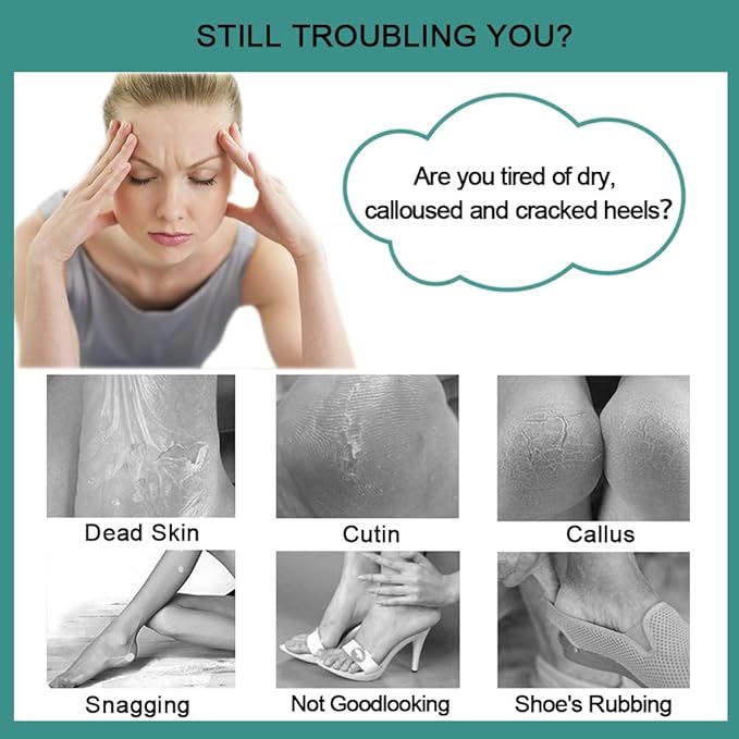 CAREHOOD Foot File Callus Remover - Multi Purpose 4 in 1 Feet Pedicure Tools with Foot Scrubber, Pumice Stone, Foot Rasp and Sand Paper for Home Foot Care (Red Pedicure Foot File)