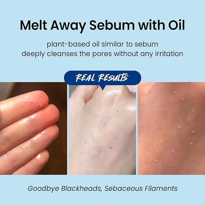 coxir ULTRA HYALURONIC CLEANSING OIL, Travel-Size, Korean Facial Cleanser l Blackhead, Makeup Removal with Hyaluronic Acid, Cruelty Free, No Mineral Oil [1.69fl.oz (Pack of 1)]