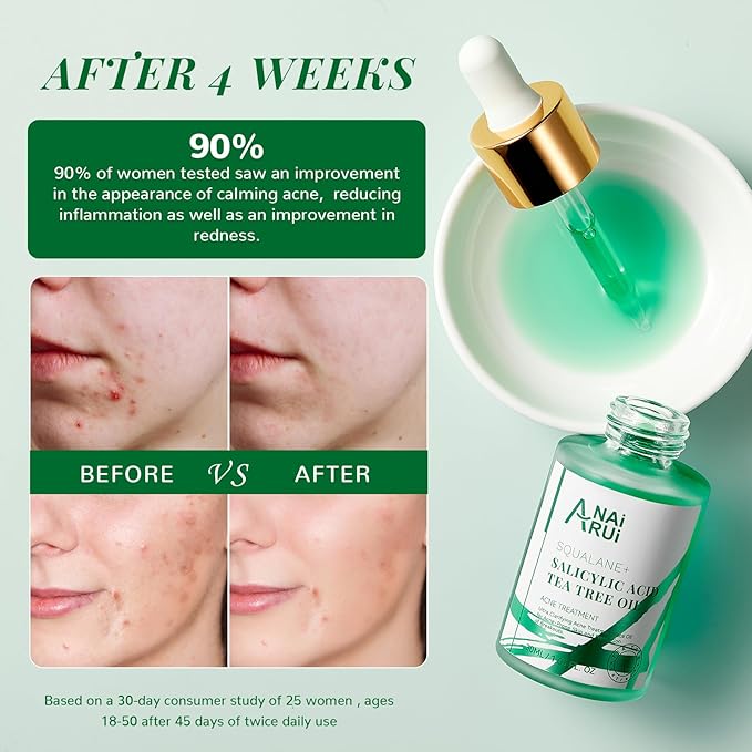 ANAI RUI Acne Face Oil,Tea Tree Oil with Salicylic Acid,Acne Prone Skin Oil,Soothe Acne,Redness Relief, Tea Tree Oil for Face,Back, Clarifying & Purifying 1Fl.OZ