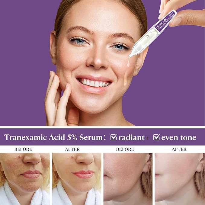 5% Tranexamic Acid Serum Ampoule for Face with Niacinamide,Kojic Acid & Alpha Arbutin,Skin Glowing Serum for Dark Spots,Even Out Skin Tone,30 Ampoules