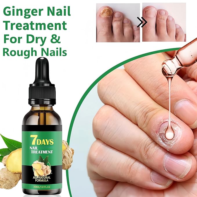 2Pcs Ginger Nail Growth and Strengthener-Nail Growth Serum-30ML Each Natural Nail Strengthener for Damaged Nails-Ginger Nail Treatment
