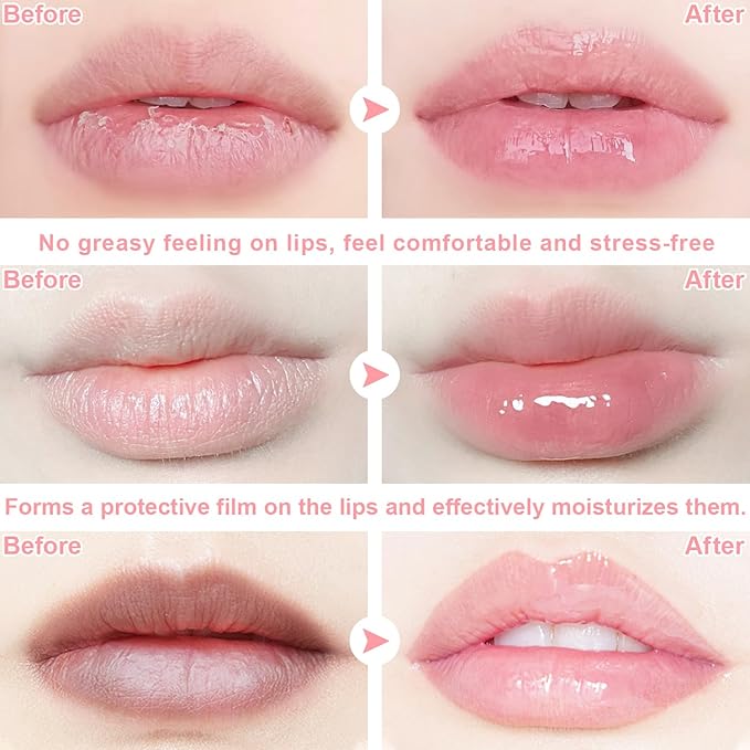 6 PCS Bee Lip Balm Honey Pot, Propolis Lip Mask Overnight, Moisturizing Hydrating Lip Sleeping Mask Prevention Dry and Cracked, Reduce Lip Lines (Strawberry&Watermelon&Honey&Cherry&Coconut&Apple Lime)