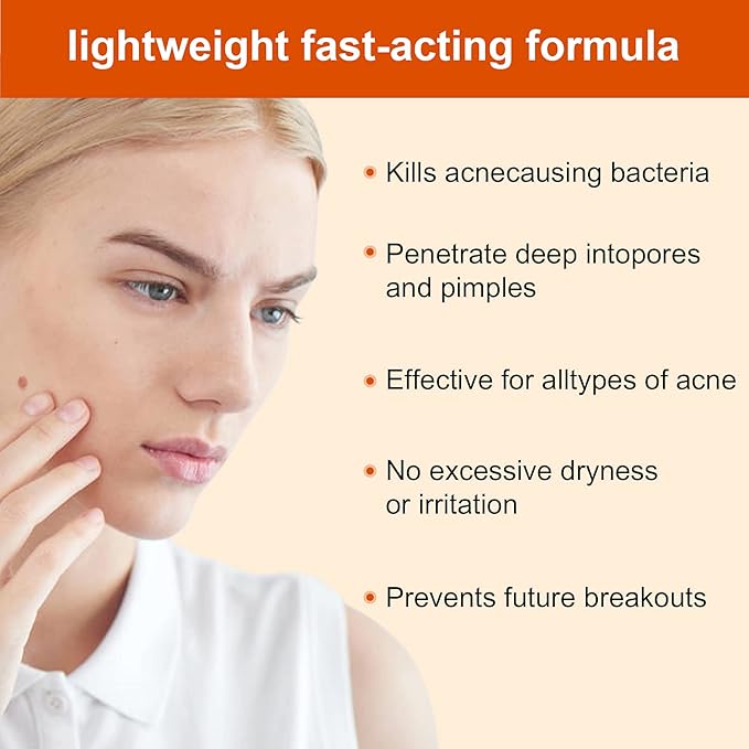 Acne Treatment Cream for Face & Body - Anti-acne Moisturizer for Teens & Adults - Spot Treatment for Breakouts & Blemishes - 30g