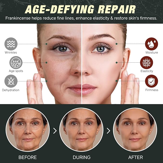 Beef Tallow for Skin & Face Cream with Castor Oil and Frankincense,120g,Organic Natural 100% Grass Fed,Whipped Beef Tallow Balm Deeply Moisturizing for Face & Body Care,4.2 oz