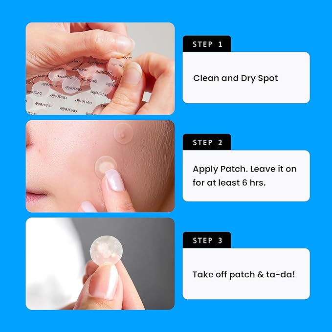 AVARELLE Pimple Patches Hydrocolloid Acne Patches, Acne Spot Treatment for Blemishes and Zit with Tea Tree Oil, Calendula Oil and Cica Oil for Face, Vegan, Cruelty Free Certied (40 CT + 80 CT)