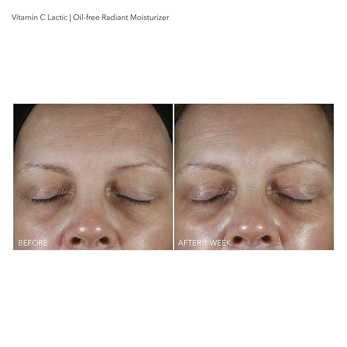 Dr Dennis Gross Vitamin C Lactic Oil-Free Radiant Moisturizer: For Dullness, Uneven Tone & Texture, Fine Lines and Occasional Dryness, 1.7 oz