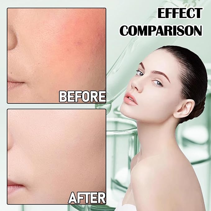 8Pcs Organic Aloe Vera Gel for After Sun Skin Care,Natural Moisturizing Aloe Vera Gel for Face & Body,Easy to Portable Face Moisturizer,Travel Size Pure Vera Aloe Gel for all Skin Types H