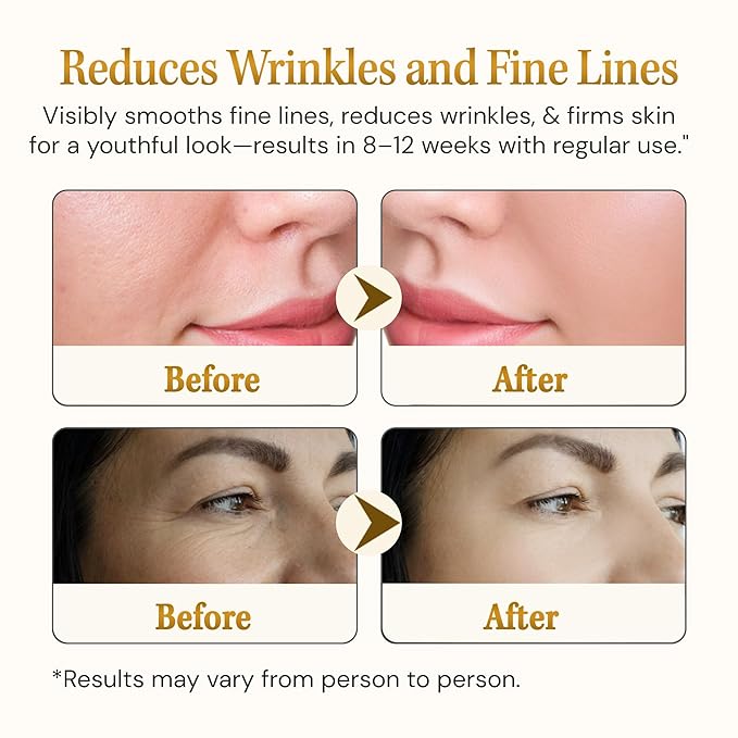 Anti Aging Serum Matrixyl 3000 with Hyaluronic Acid, Peptide Collagen & Argireline – Best Deep Wrinkle Repair & Hydrating Face serum – All skin types Korean Matrixyl Serum 1.01 Fl Oz