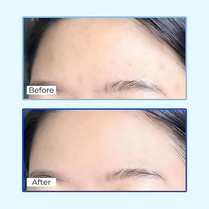 ALIVELAB Centella Dressing Powder – K-Beauty Acne Treatment, Calming Spot Care with Centella Asiatica for Sensitive, Oily Skin, Korean Skincare for Pimples & Redness (0.27oz)