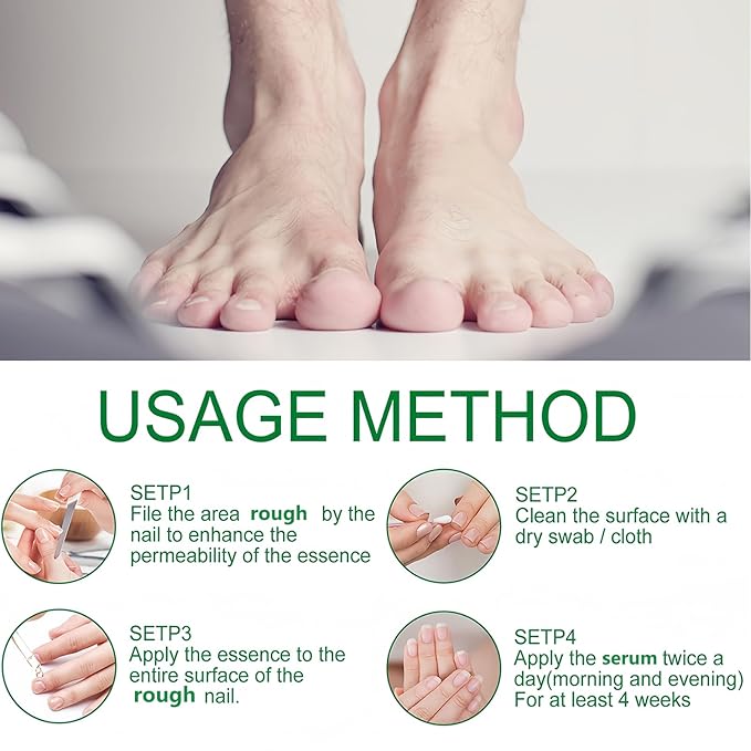 2Pcs Ginger Nail Growth and Strengthener-Nail Growth Serum-30ML Each Natural Nail Strengthener for Damaged Nails-Ginger Nail Treatment