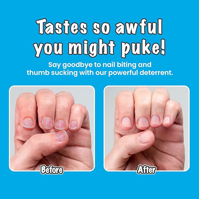 Nail Deterrent, Treatment for Kids and Adults, Non-Glossy Invisible Coating, Stop Nail Biting and Thumb Sucking Today, 0.3 Fl Oz