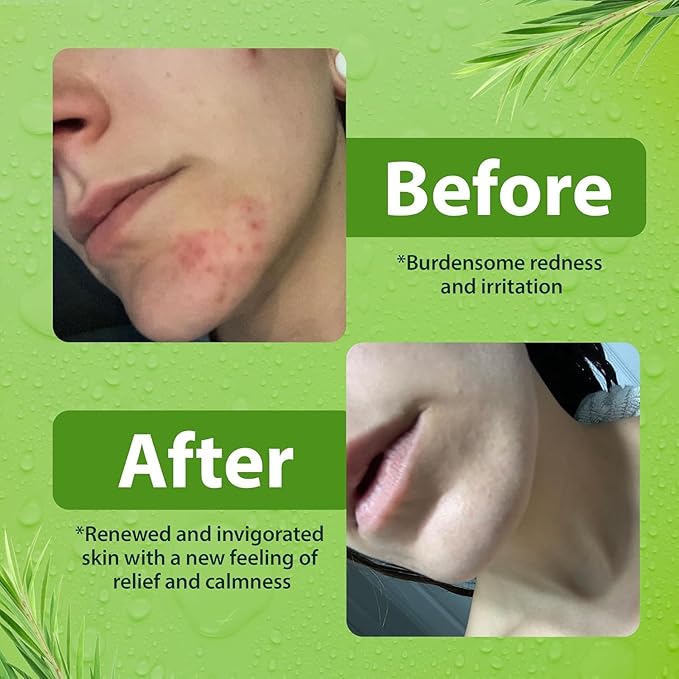 Derma-Nu Therapeutic Antibacterial Soap & Tea Tree Body Wash – For Jock Itch, Athlete’s Foot, Eczema & Back Acne –For Men and Women Safe for All Skin Types – 12 oz