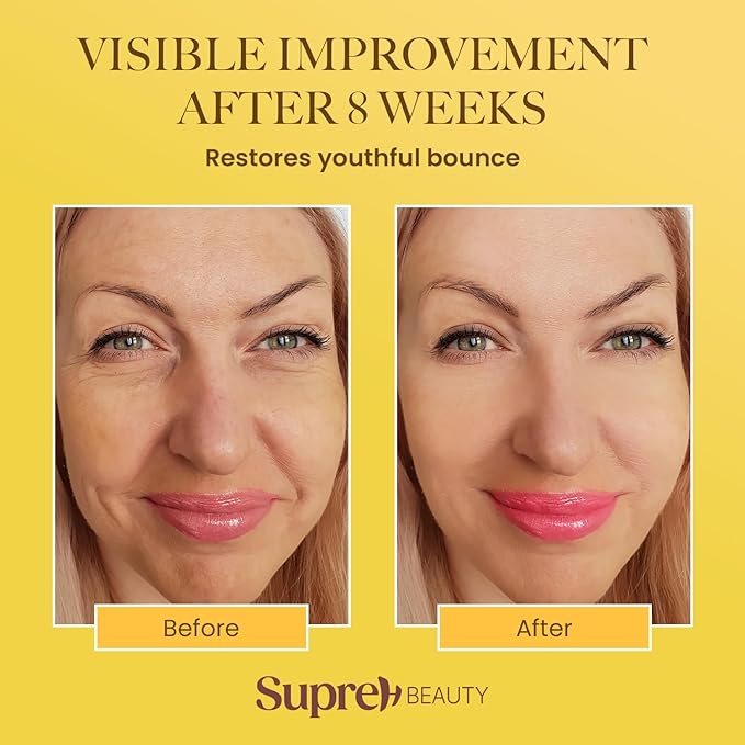 Bee Venom Wrinkle Cream: Bee Venom Skin Treatment Cream Restoration with Hyaluronic Acid Niacinamide and Peptides - for fine lines and face firming 50ML