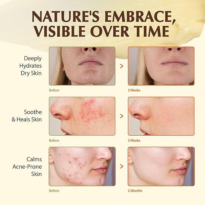 Beef Tallow Sunscreen with Zinc Oxide: Natural Non-Toxic SPF 50 Tallow Sunblock Cream for Face & Body - with 10 Food-Grade Botanical Extracts (Tallow Balm + SPF 50 Sunscreen)