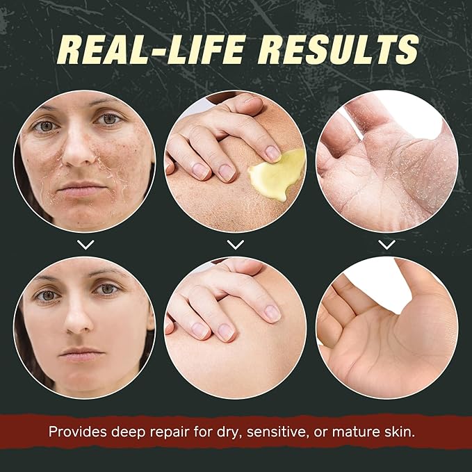 Beef Tallow for Skin & Face Cream with Castor Oil and Frankincense,120g,Organic Natural 100% Grass Fed,Whipped Beef Tallow Balm Deeply Moisturizing for Face & Body Care,4.2 oz