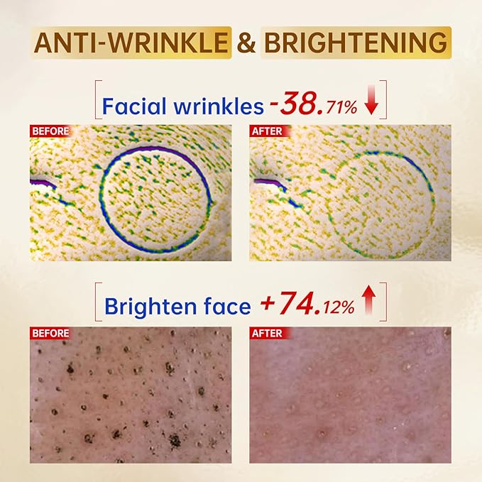 2 Pack Vitamin C Face Serum with Vitamin C, Hyaluronic Acid, Vitamin E, Serum for Dullness, Balanced Complexion, Eye Area, Fine Lines & Wrinkles, 30ml/1.01oz