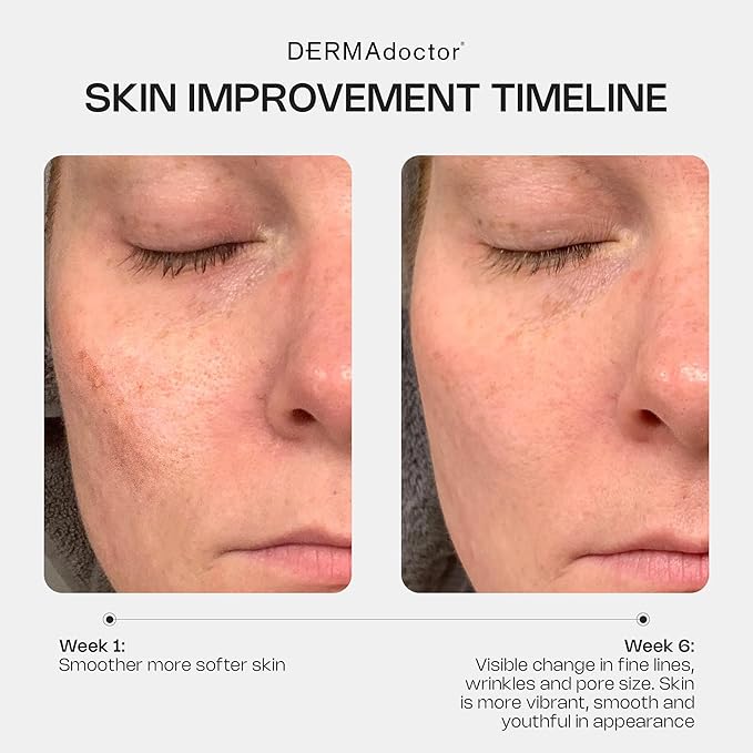 DERMAdoctor Retinol Cream for Face - Stable Vitamin C & E, Ferulic Acid Anti Aging Face Cream 1% Retinol Vitamin C Facial Moisturizer Night-Cream for Dullness, Discoloration, Fine Lines, & Wrinkles