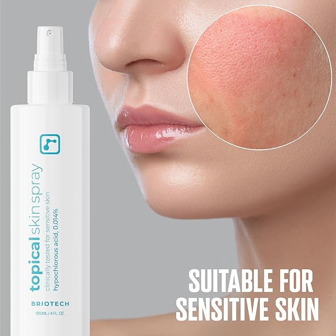 BRIOTECH Topical Skin Spray, Hypochlorous Acid Spray for Sensitive Skin, HOCl Facial Mist, Full Body Support Against Irritation, Calm Redness, Soothe Foot & Scalp, 4 oz