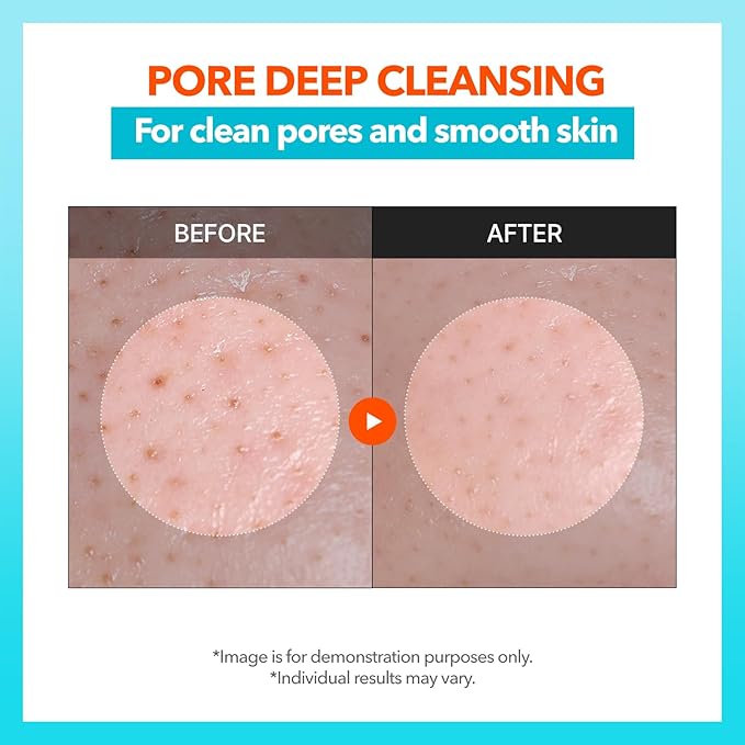 Cell Fusion C PHA Enzyme Pore Cleansing Oil, Makeup Remover with Enzyme, PHA & Jojoba Oil, Removes Blackheads & Sebum, Lightweight Facial Cleanser, 6.76 fl.oz / 200ml