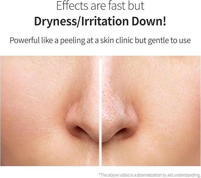 Benton Glycolic Acid 7% Exfoliating Toner with Niacinamide - Gentle AHA Toner for Brighter Skin & Even Tone - Balances Oil & Moisture - Hydrating, Cruelty-Free Korean Skin Care