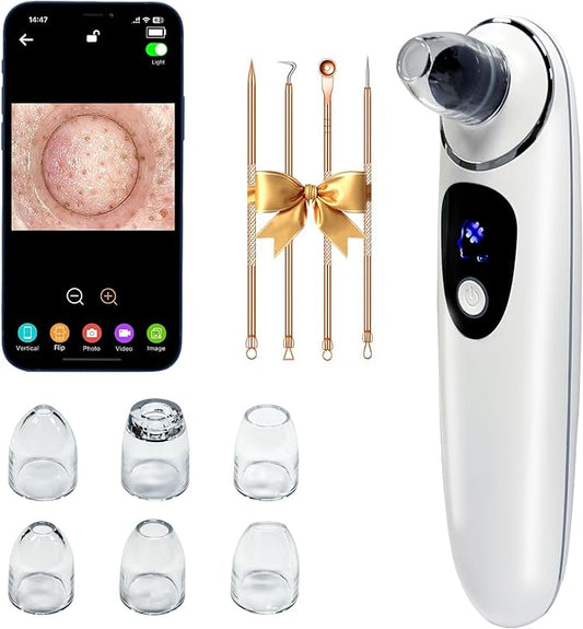 2025 Pore Vacuum with Camerafor, USB Rechargeable Blackhead Remover Vacuum,3 Levels Adjustable Pore Vacuum Blackhead Remover, 6 Suction Heads,Face Vacuum Pore Cleanser for Women & Men
