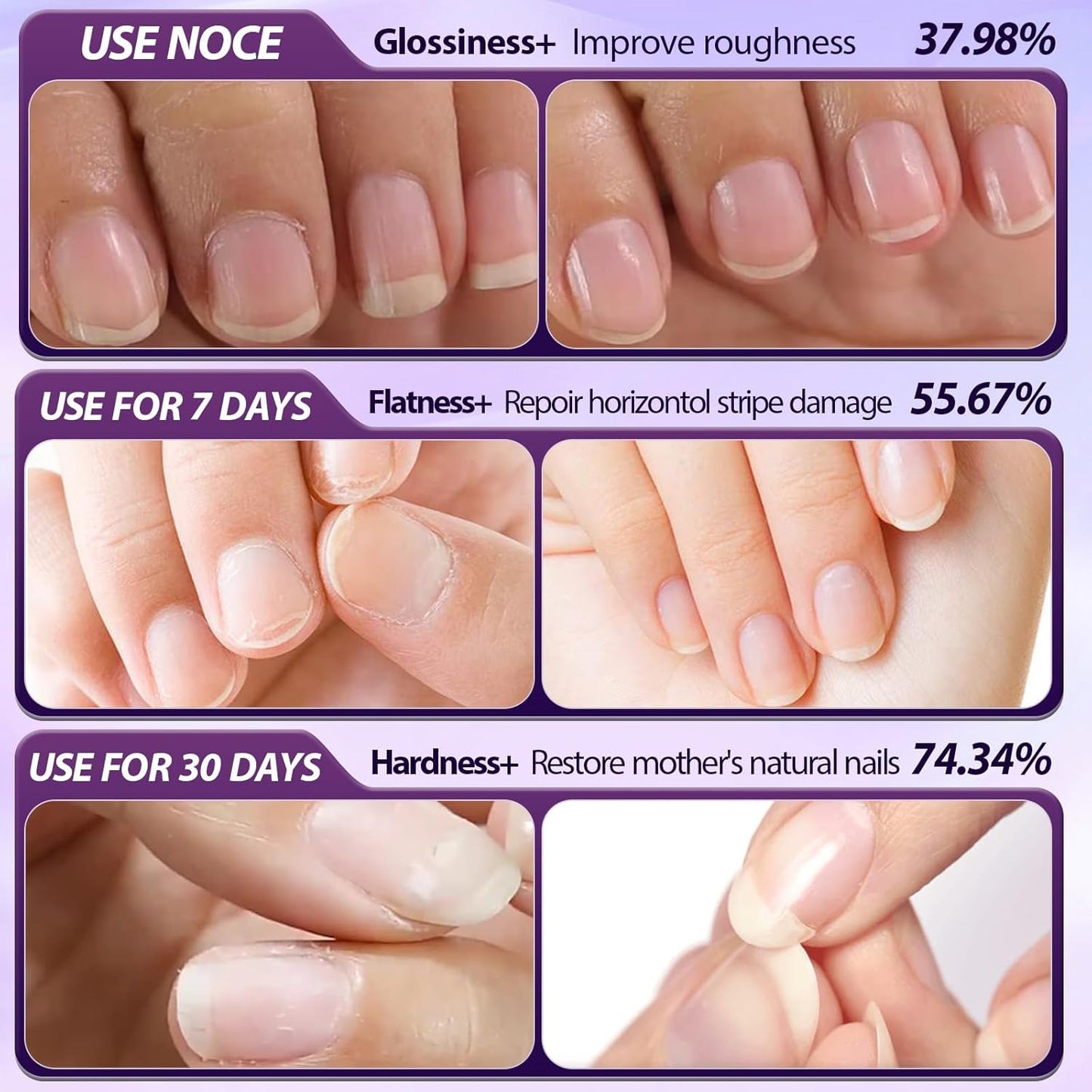 3-in-1 Cuticle Oil Pen for Nails - Nail Care Tool with Ceramic Tip, Moisturize Strengthen Brighten - Cuticle Pusher Oil for Hangnails, Dry & Damaged Nails（3pc）