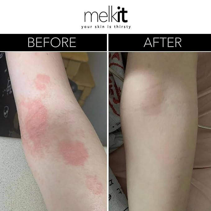 Body Melk Natural Body Cream - All Over Fast-Absorbing Hydration for Dry or Sensitive Skin - Soothe Sensitive Skin, Rash & Irritation - All Skin Types - 16 oz