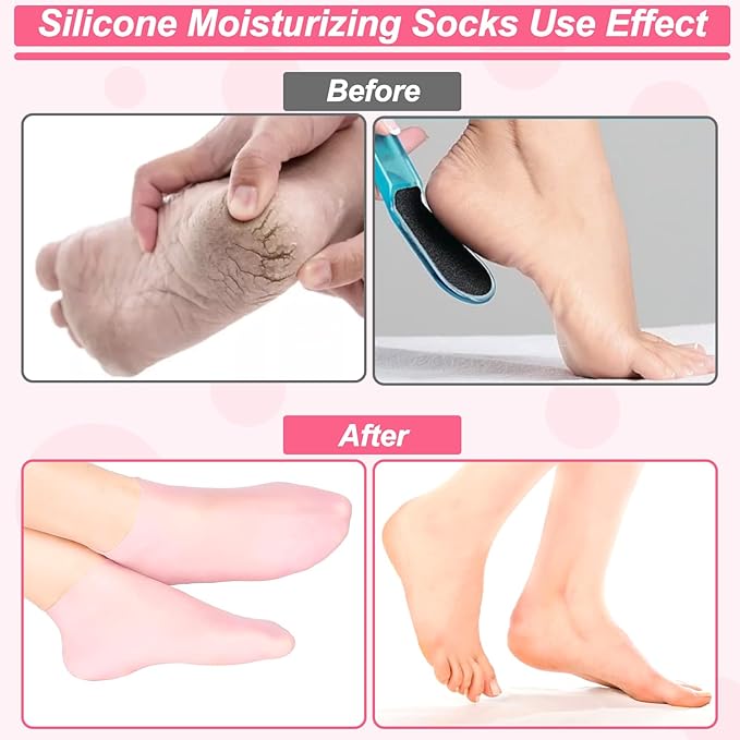 BUSOHA 3 Pairs Silicone Socks for Dry Cracked Feet Women, Moisturizing Socks, Foot Spa Pedicure Silicone Socks
